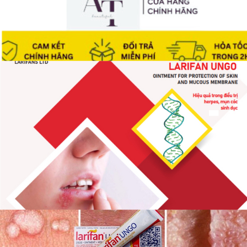 Kem bôi Larifan Ungo ngăn ngừa mụn rộp, sùi mào gà, Herpes 10g xuất xứ Châu Âu.