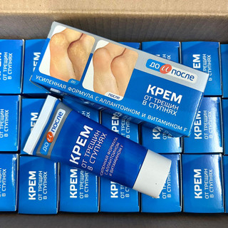 Kem ngăn ngừa và hồi phục nứt nẻ gót chân kpem nga 50ml