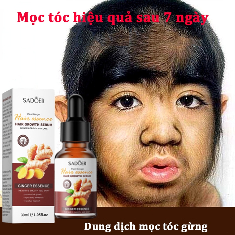 Serum MọC TóC ThuốC MọC TóC KíCh MọC TóC ThuốC MọC TóC Nhanh ChăM SóC TóC DưỡNg ẩM BảO Vệ Sự PháT TriểN CủA TóC 30ml
