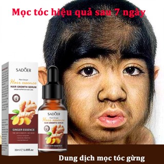 Serum MọC TóC ThuốC MọC TóC KíCh MọC TóC ThuốC MọC TóC Nhanh ChăM SóC TóC DưỡNg ẩM BảO Vệ Sự PháT TriểN CủA TóC 30ml