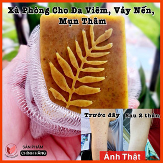 Xà Phòng Thảo Mộc Lên Men Nghệ Mật Ong - Chuyên Dành Cho Da Vẩy Nến, Viêm Da, Mụn Ngứa, Thâm Nám | Linhducon