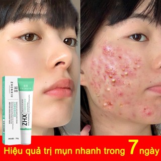 Kem Mụn nhanh chóng loại bỏ mụn bọc 20g kem bôi mụn, phục hồi vết tích mụn và mụn, làm mờ thâm mụn