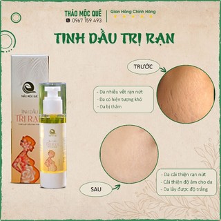 Tinh Dầu Cọ Thiên Nhiên THAO MOC QUE Chống Rạn Cho Mẹ Sau Sinh & Phục Hồi Da Bụng Giúp Săn Chắc Sáng Da Đều Màu