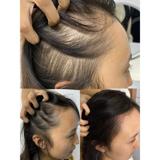 Dầu Ủ Kích Mọc Tóc Và Phục Hồi Aura Biotin