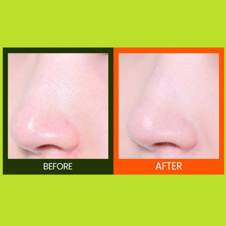 Mặt nạ đất sét BEPLAIN Mung Bean Pore Clay Mask 120ml