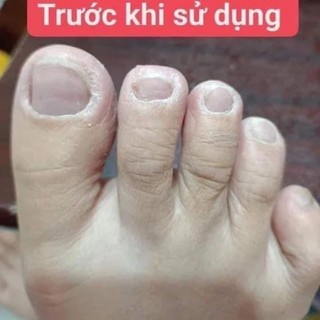 Kem bôi da thảo mộc tuýp 15gr