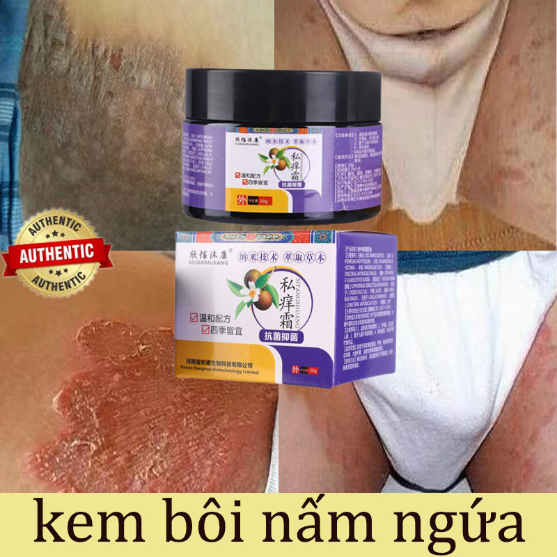 Kem Bôi Nấm Ngứa Viêm Kem bôi nấm ngứa kem chống ngứa Kem giảm ngứa kem bôi hết sạch nấma ngứ Kem bệ