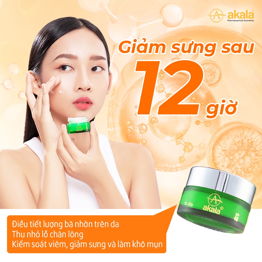 Kem Mụn - Mờ Thâm - Liền Sẹo - Kiềm Dầu akala ( Nhuỵ hoa nghệ tây & 7 loại thực vật quý ) 22 gram