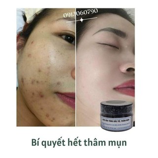 Kem xoá thâm nách, thâm mụn, xoá tăng sắc tố Eva
