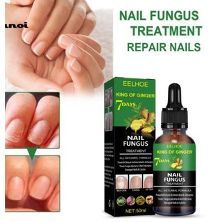 Serum nấm móng tay chân hết sạch nấm, bọng móng, hư khoé, nước ăn tay chân, dưỡng cứng móng eelhoe