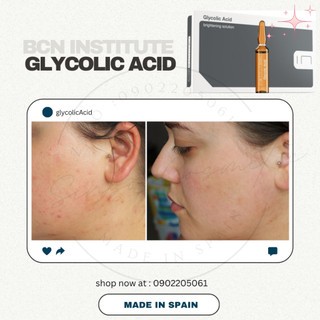 Trắng da Glycolic Acid BCN sáng da hết thâm