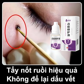 Tẩy nốt ruồi Thuốc mụn cóc Kem loại bỏ mụn cóc 10ml Tẩy nốt ruồi hiệu quả Nhanh chóng Không đau