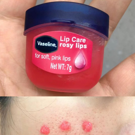 VASELINE SON DƯỠNG MÔI LIP THERAPY 7G