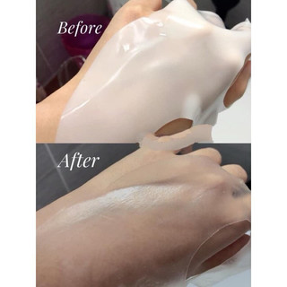 Derm All Matrix - Mặt Nạ Thạch Derm All Matrix