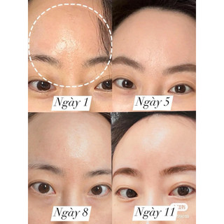 [Hàng sẵn]SERUM  Neostrata Clarify 𝐌𝐚𝐧𝐝𝐞𝐥𝐢𝐜 𝐌𝐚𝐭𝐭𝐢𝐟𝐲𝐢𝐧𝐠 𝐒𝐞𝐫𝐮𝐦