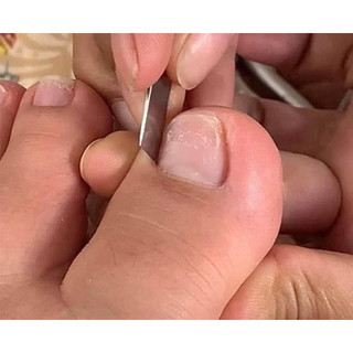 sét combo lấy khoé cao cấp