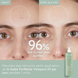 Sữa rửa mặt Caudalie VINOPURE 385ml