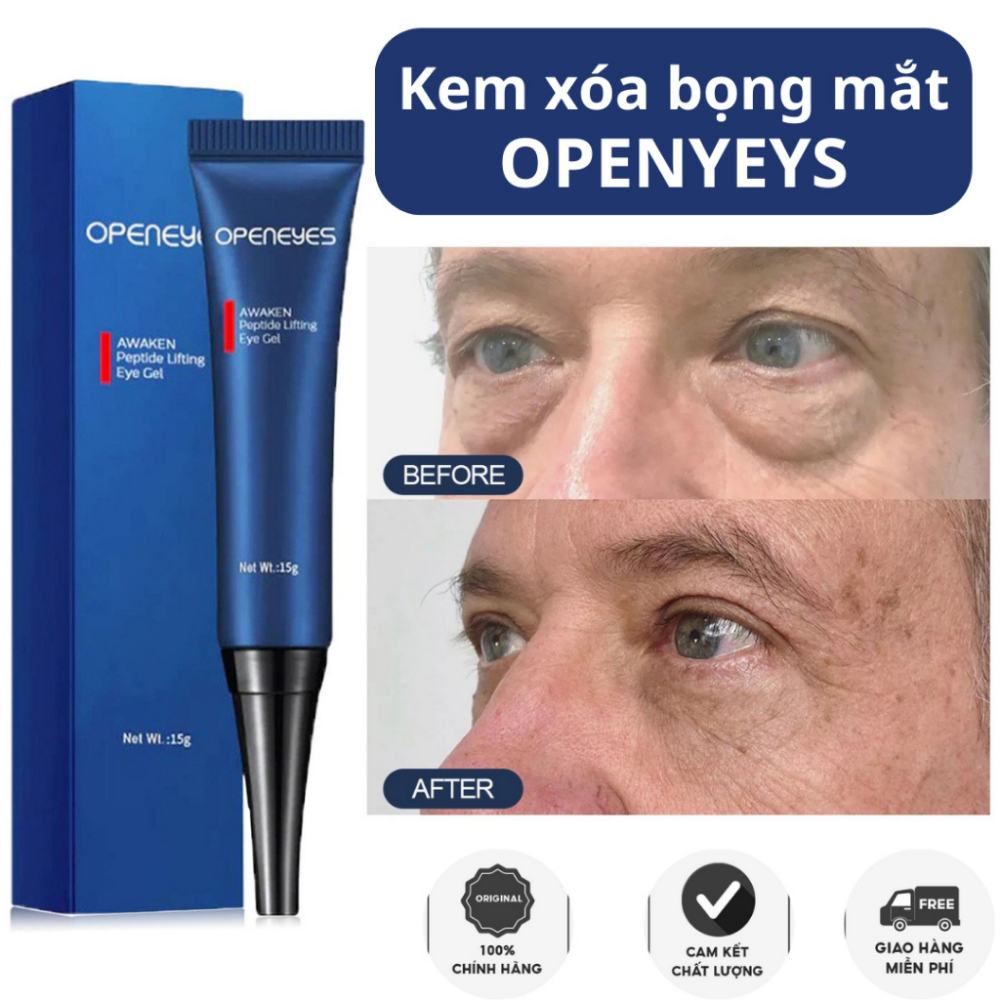 Kem Xoá Bọng Mắt Openeyes - Kem Openeyes Dưỡng Ẩm Giúp Mờ Nếp Nhăn, Loại Bỏ Quầng Thâm Và Tan Bọng Mắt