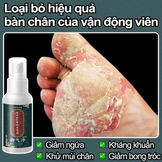 Xịt khử mùi hôi chân 35ml Giảm ngứa chân hiệu quả Khử mồ hôi chân Phồng rộp và khử mùi hôi chân