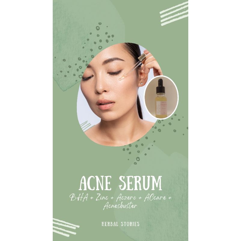 Serum Giảm Mụn, Thu Nhỏ Lỗ Chân Lông Herbal Stories 20ml