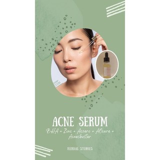 Serum dành cho da mụn 20ml