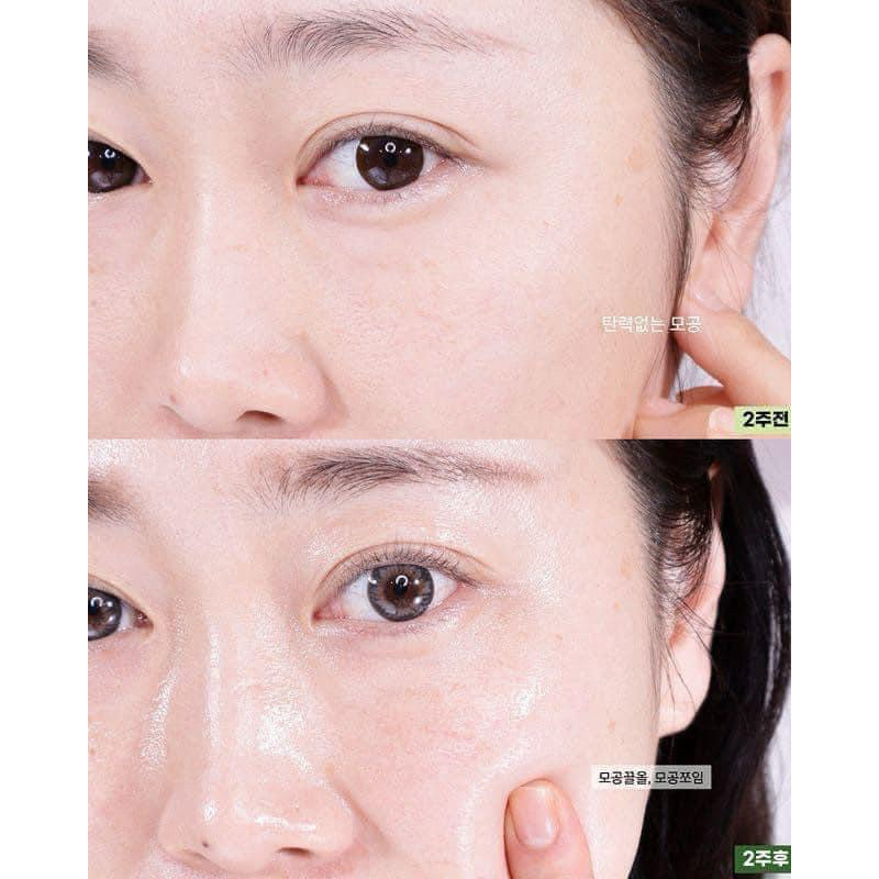 (Seung Thảo) Tinh chất SE KHÍT LỖ CHÂN LÔNG Beplain Mung Bean 30ml | BigBuy360 - bigbuy360.vn