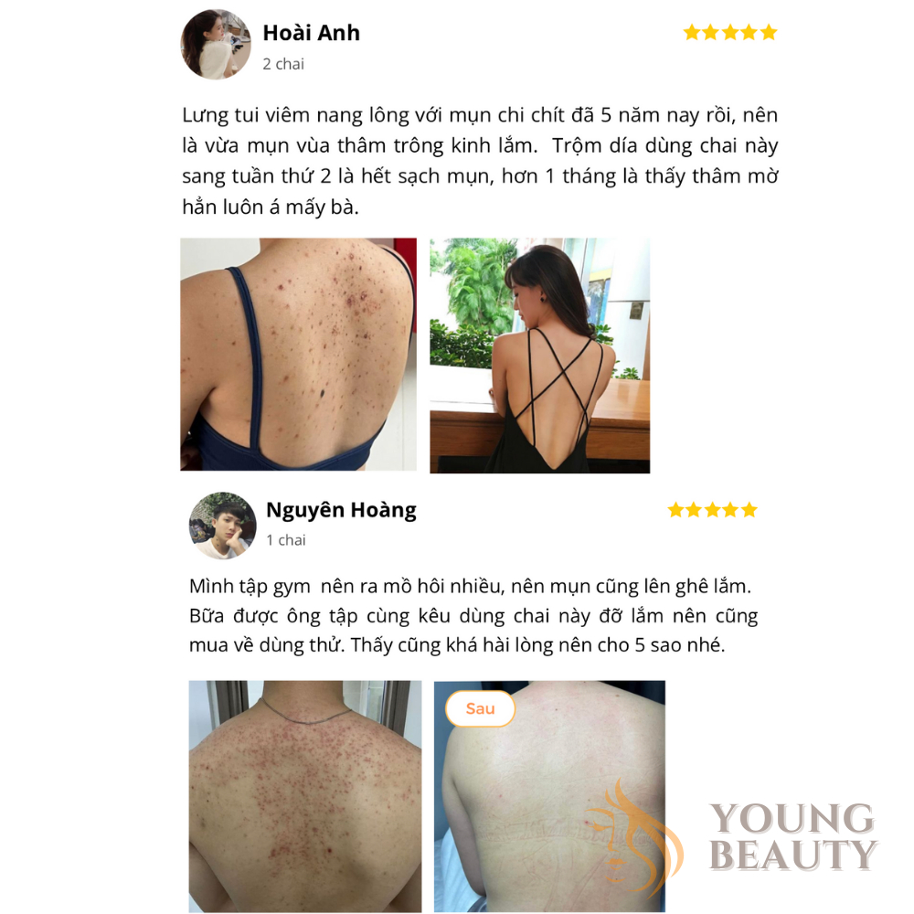 Tinh chất tắm dược liệu CLEAN, Chặn mụn ngăn thâm, Không lo tái phát, Dung tích 500ml - YOUNG BEAUTY