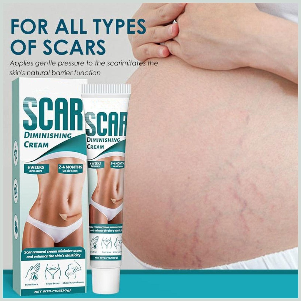 Kem Phẳng Mờ Sẹo Rạn Da Scar Diminishing Cream - Kem Dưỡng Ẩm Giảm Vết Rạn Da Mờ Sẹo Giúp Da Tăng Sự Đàn Hồi Da