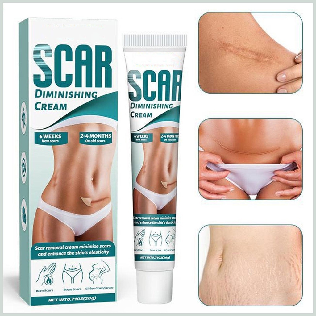 Kem Phẳng Mờ Sẹo Rạn Da Scar Diminishing Cream - Kem Dưỡng Ẩm Giảm Vết Rạn Da Mờ Sẹo Giúp Da Tăng Sự Đàn Hồi Da