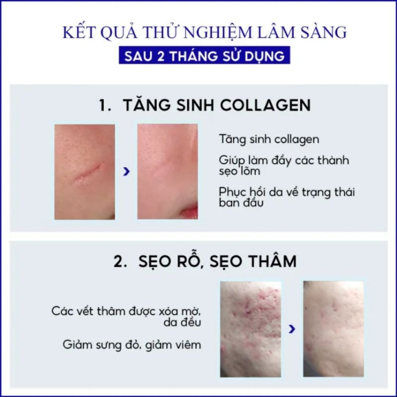 Kem Tế Bào Gốc Shark Scar Repair Cream - Kem Shark Scar Giúp Loại Bỏ Sẹo Rỗ, Sẹo Lõm, Sẹo Thâm Do Mụn Và Dưỡng Da