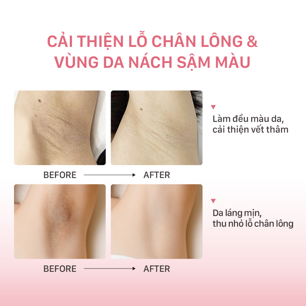 vn 11134207 7r98o lvybdktf23tle5