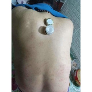Kem thảo mộc bôi da 10gr
