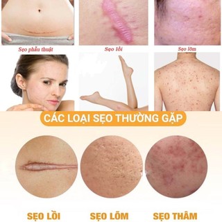 KEM LÀM MỜ SẸO KLIRVIN NGA