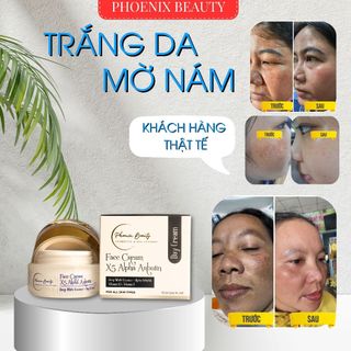 Kem Nám Ngày X5 Alpha Arbutin Ban Ngày Dưỡng Trắng Mờ Nám