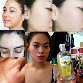 [Bill Mỹ] Toner cây phỉ Dickinson's Original Witch Hazel 473ml