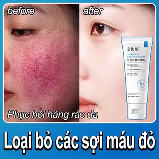 Kem phục hồi da B5 Kem làm dịu da Bisabolol 40ml Loại bỏ các sợi máu đỏ và phục hồi hàng rào da mặt