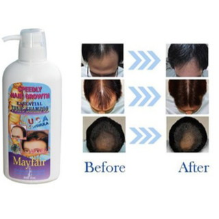 dầu gội kích mọc tóc MAYFAIR 500ml