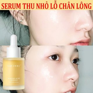 Serum se khít lỗ chân lông se khít lỗ chân lông 30ML se khít lỗ chân lông mặt dưỡng da mặt trắng