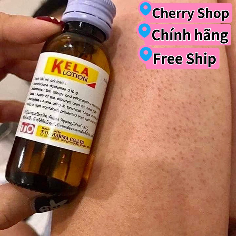 KELA LOTION VIÊM LỖ CHÂN LÔNG 60ml