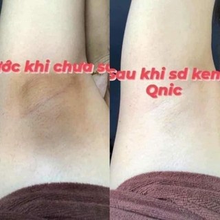 𝐊𝐞𝐦 𝐭𝐡𝐚̂𝐦 𝐧𝐚́𝐜𝐡 𝐐𝐧𝐢𝐜 𝐂𝐚𝐫𝐞 𝐓𝐡𝐚́𝐢 𝐋𝐚𝐧 ( mẫu mới)