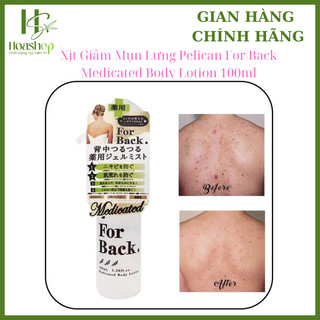 Xịt mụn lưng For Back Body Lotion 100ml