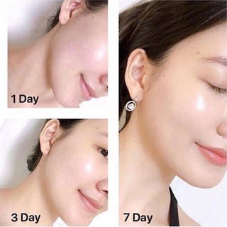 Kem dưỡng da mặt Olay Total Effects 7in1