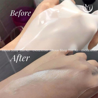 Nạ Thạch Derm'All Matrix