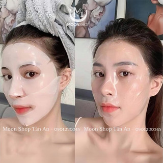 Nạ Thạch Derm'All Matrix