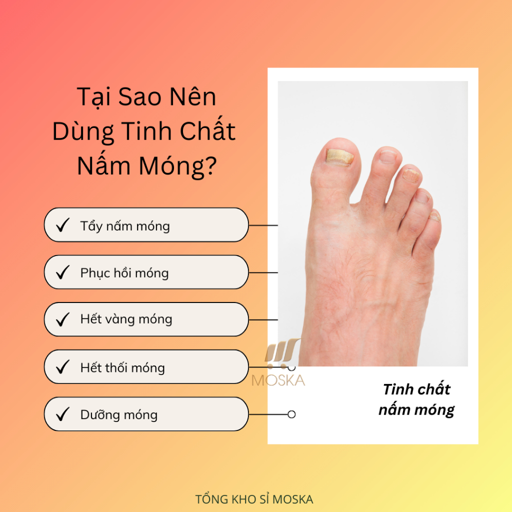 Tinh Chất Nấm Móng, Dưỡng Móng, Giảm Thối Móng KANNEDO Nhật Bản 30ml, Móng Cứng, Chắc, Phục Hồi Form Móng Hư | Moska Sho