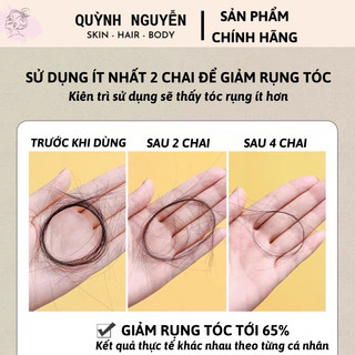 DẦU GỘI GỪNG MOFAJANG KÍCH THÍCH MỌC TÓC