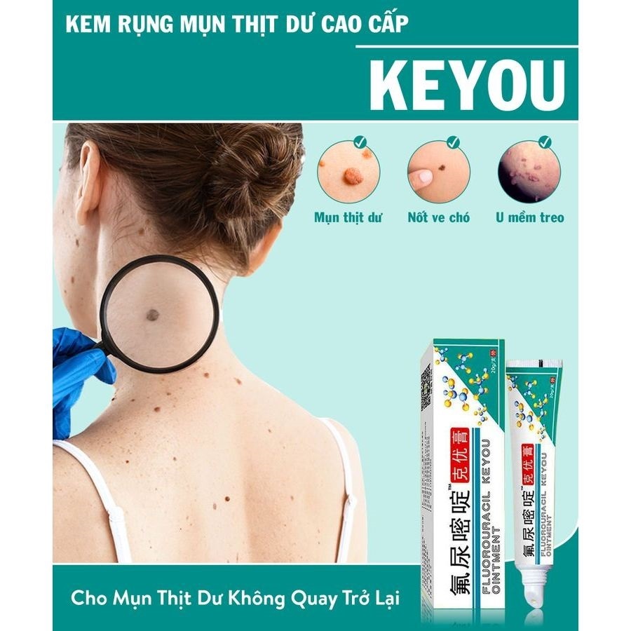 Kem Rụng Mụn Thịt Dư Cao Cấp Keyou - Kem Giúp Bật Gốc Cồi Mụ Thịt Dư, Nốt Ruồi, Mụn Cóc