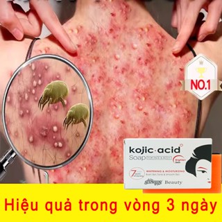 xà phòng mụn lưng  soap tắm trắng, loại bỏ Viêm nang lông Và mụn lưng, Cho Da Nhờn Và Mụn Làm sạch sâu