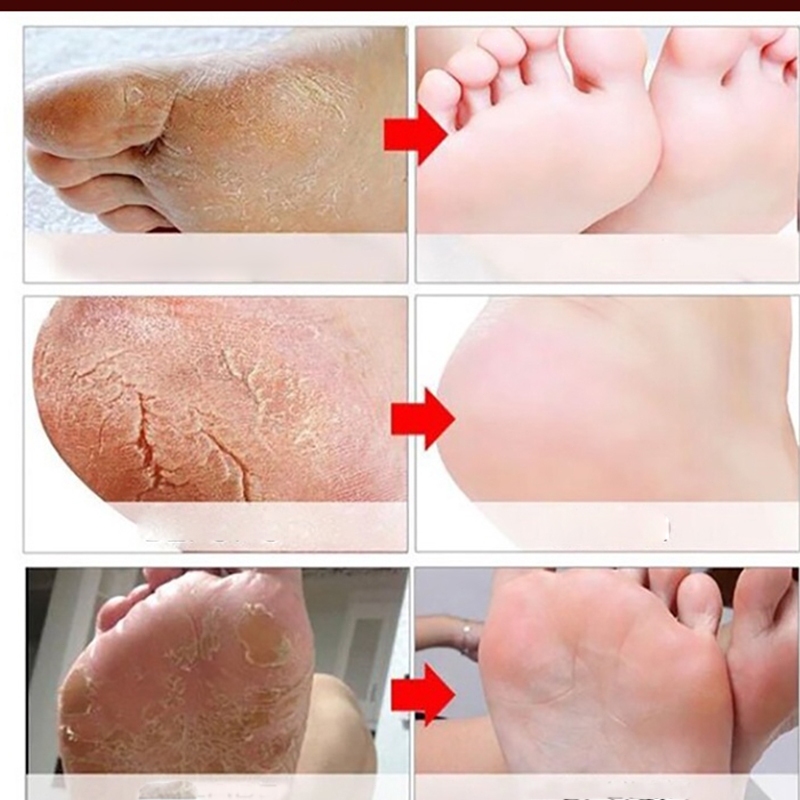 Kem Dưỡng Chân Lavender Giúp Phục Hồi Nứt Nẻ Gót Chân, Kích Thích Da Mềm Mại - Kem Dưỡng Sáng Tạo Với Tinh Dầu Lavender
