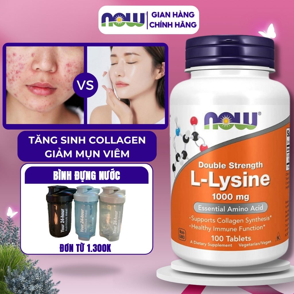 Hỗ trợ tăng sinh collagen Now L- Lysine giúp giảm mụn, hỗ trợ xương khớp 500mg 100 viên